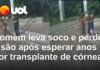 Veja Vídeo – Após esperar anos por transplante de córnea, homem perde visão ao levar soco; veja