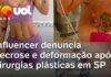 Veja Vídeo – Influenciadora relata drama após sofrer necrose e deformações em cirurgia em SP