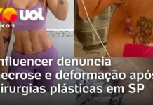 Veja Vídeo – Influenciadora relata drama após sofrer necrose e deformações em cirurgia em SP