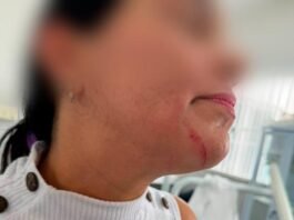Servidora é agredida por paciente em unidade de saúde