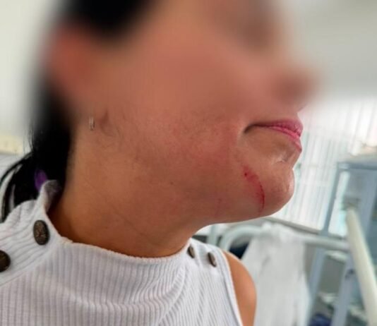 Servidora é agredida por paciente em unidade de saúde