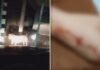 Família é obrigada a dormir dentro de carro após ataque de pitbull no quintal de casa