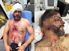 Vereador torturado durante roubo volta à UPA após piora nas dores