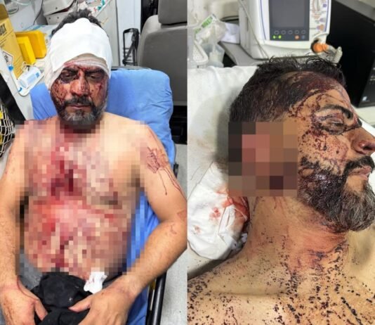 Vereador torturado durante roubo volta à UPA após piora nas dores